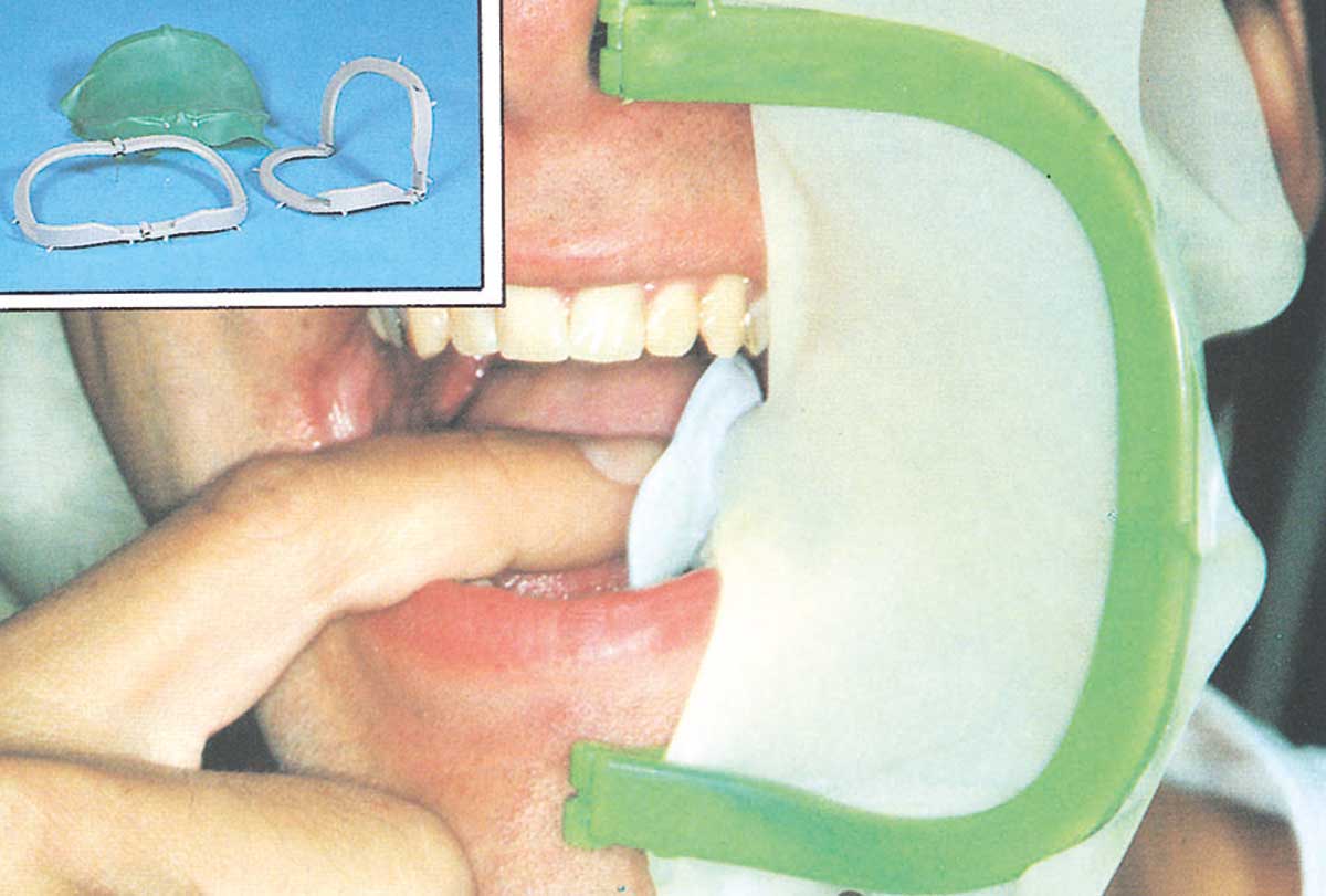 ARCO PORTA DIQUES BISAGRA HAGER WERKEN