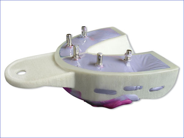 MIRATRAY IMPLANT INTRO KIT 6U HAGER WERKEN
