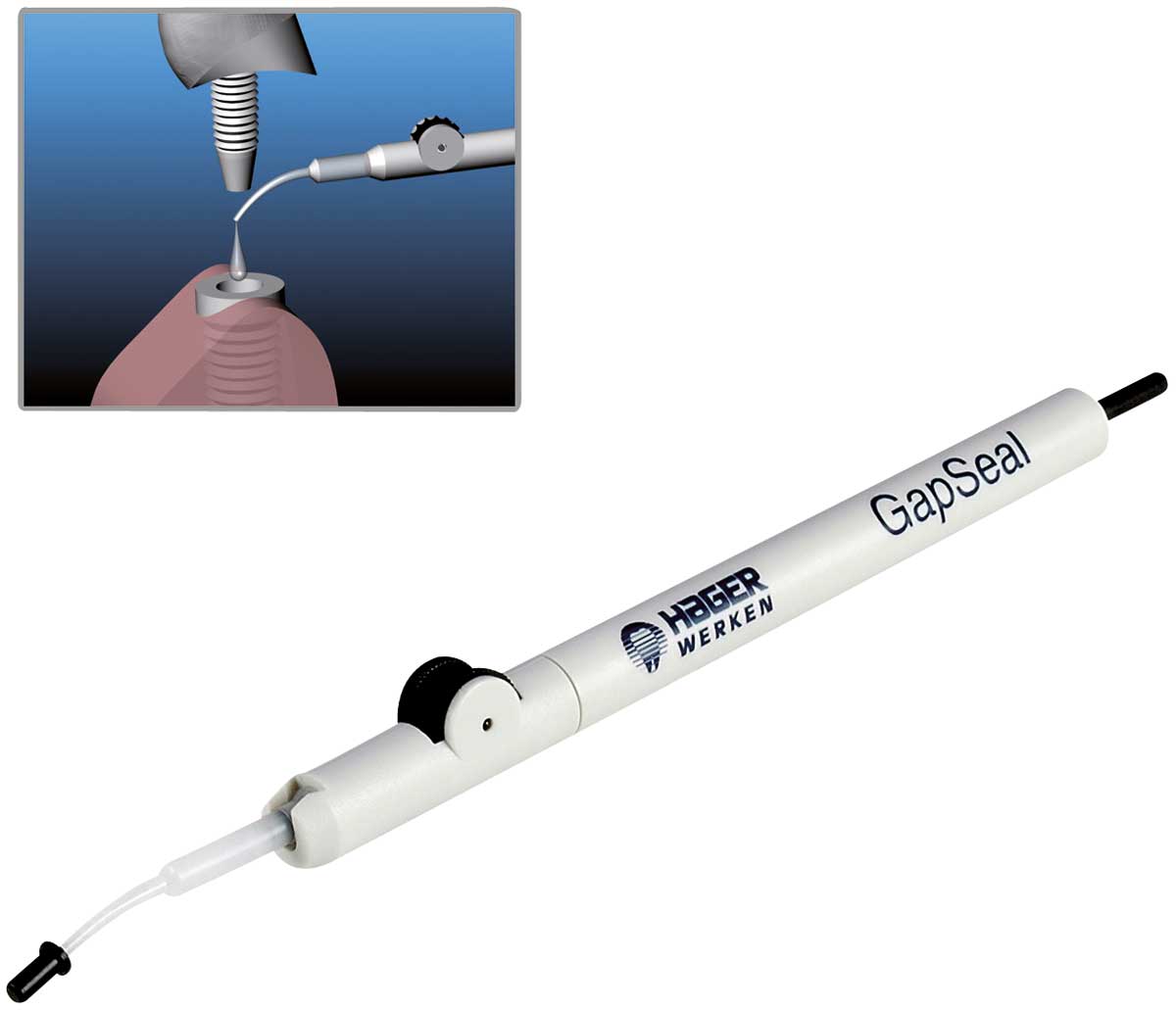 GAP SEAL SET APLICADOR + 10 PUNTAS X 0.6 ML HAGER