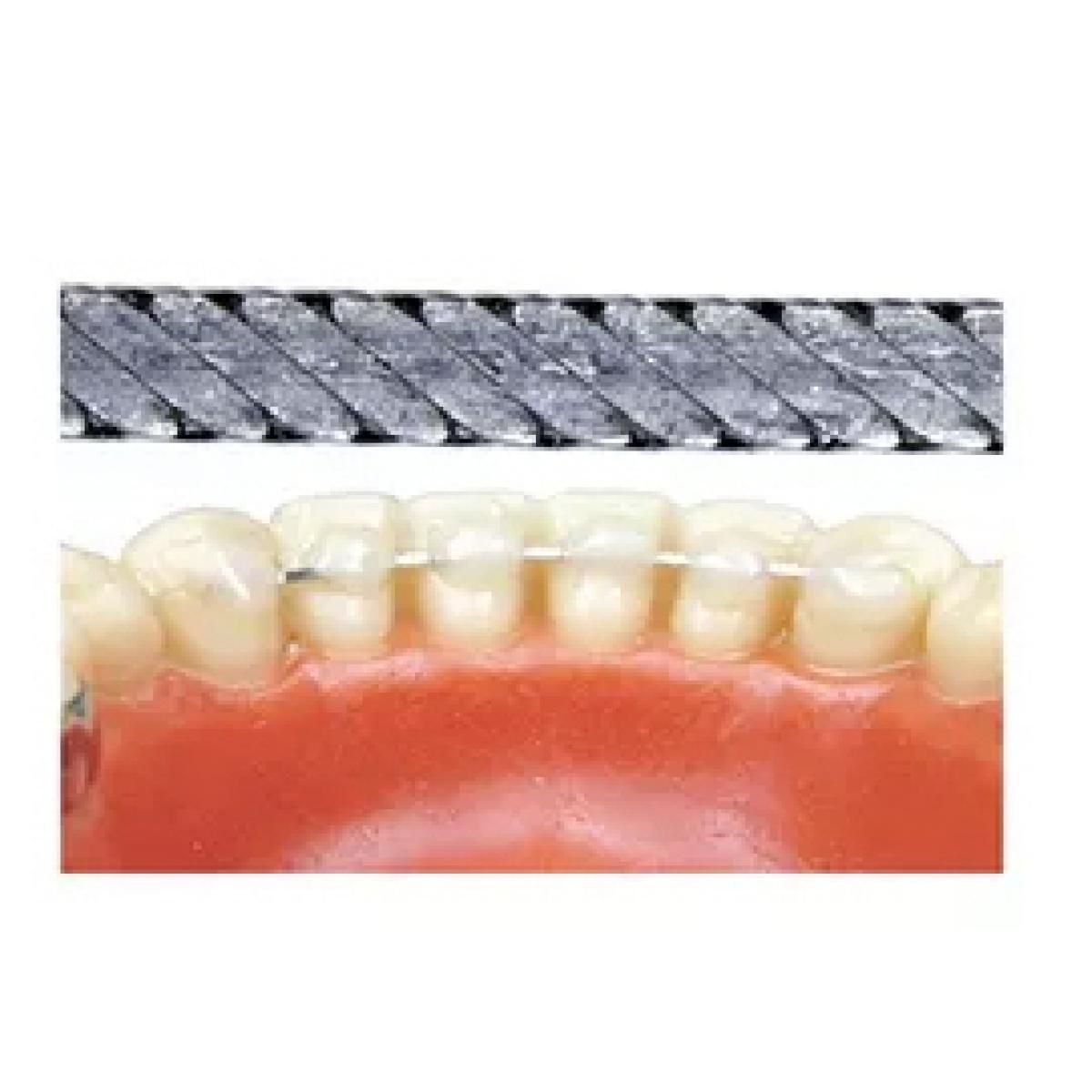 ALAMBRE RETENEDOR PLANO BOBINA 1,5M SIA