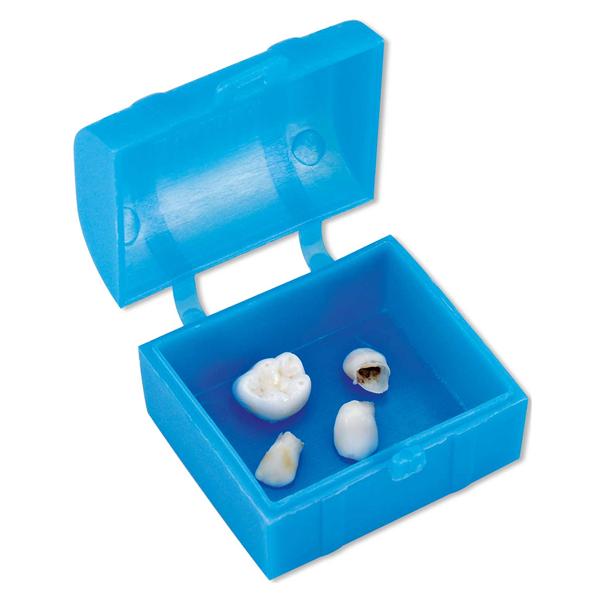 ARCAS DEL TESORO 100U.