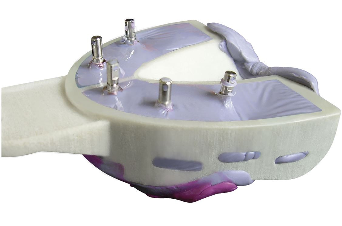 MIRATRAY IMPLANT HAGER WERKEN