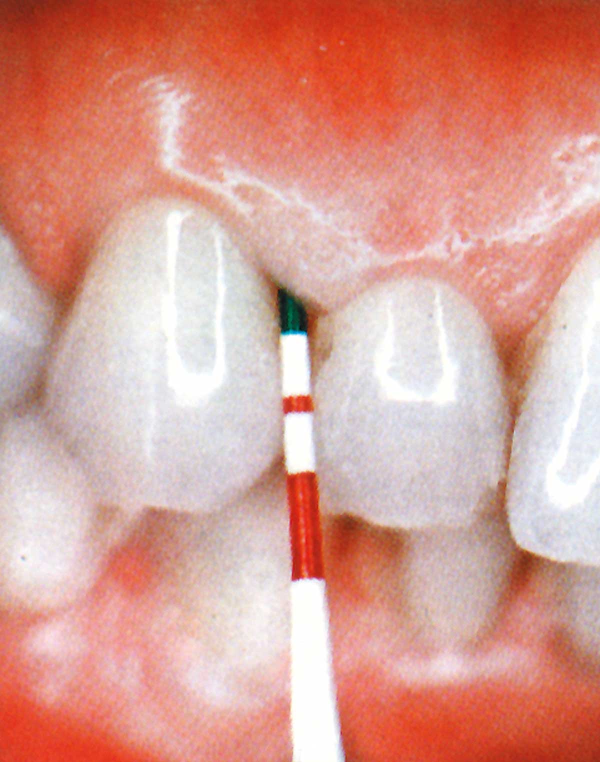 SONDA PERIOWISE 6U - PREMIER