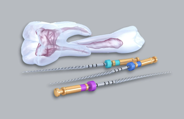 Category Endodoncia